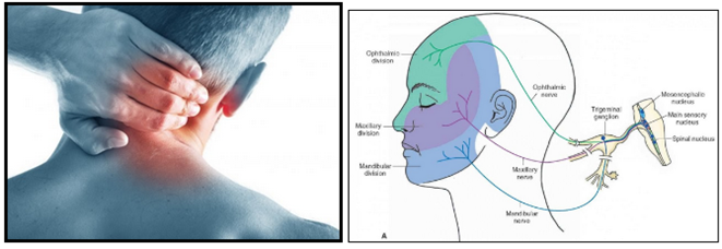 How To Stop Neck Pain Shoulder Pain And Headaches With Physiotherapy In Melbourne