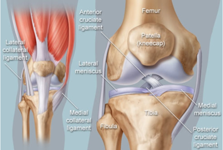 Patellofemoral Tracking Syndrome: What is It?
